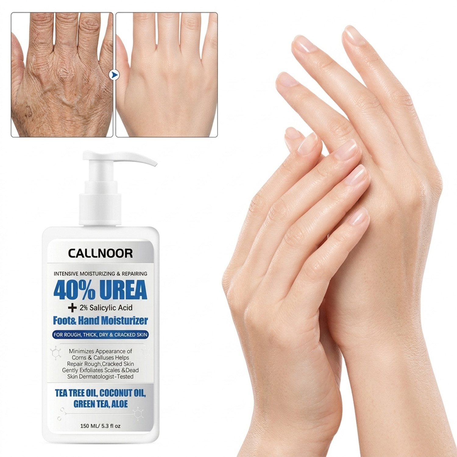 Urea Foot Cream - Crema per Mani e Piedi 0%