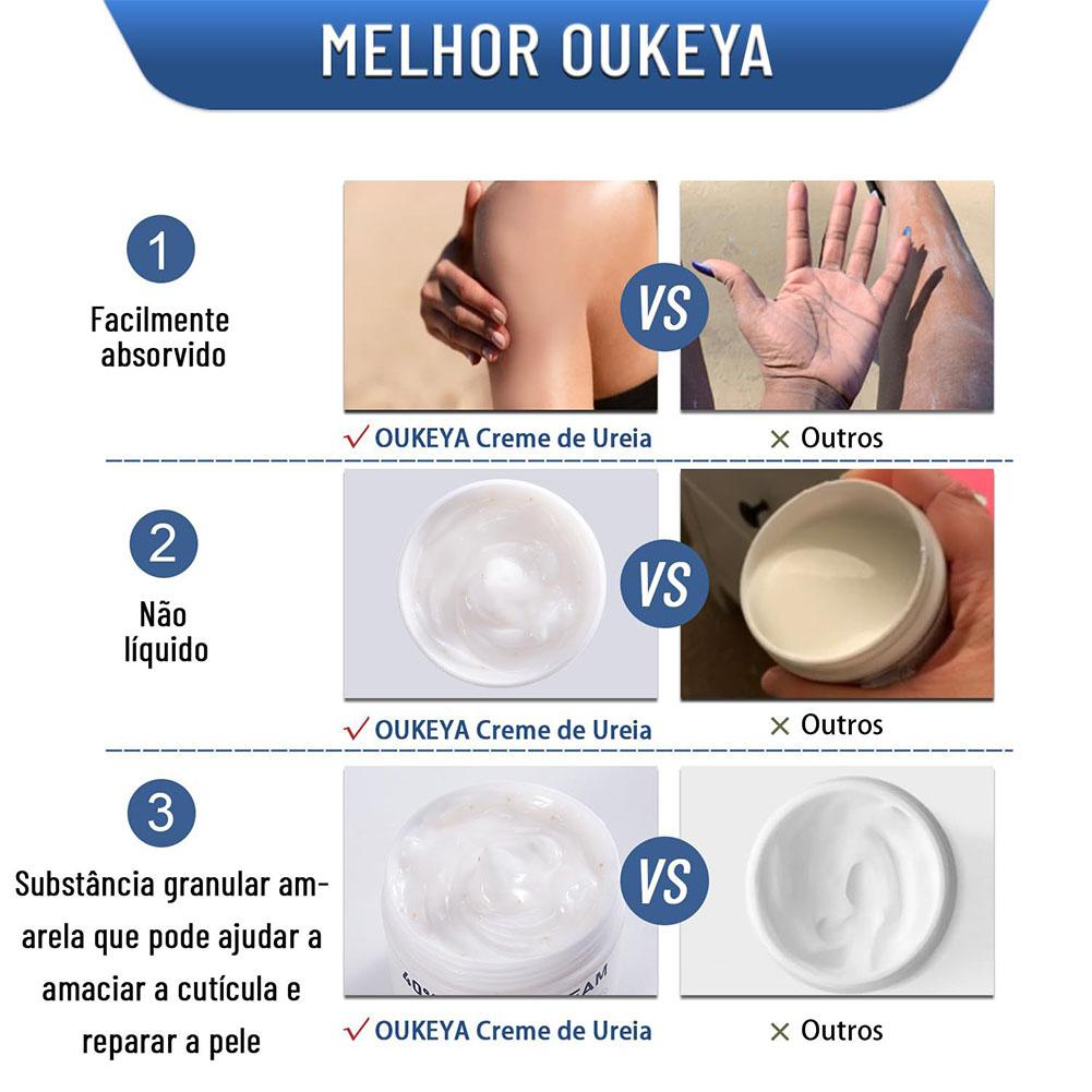 Crema all'Urea 40% Idratante A - Urea Foot Cream recensione e prezzo