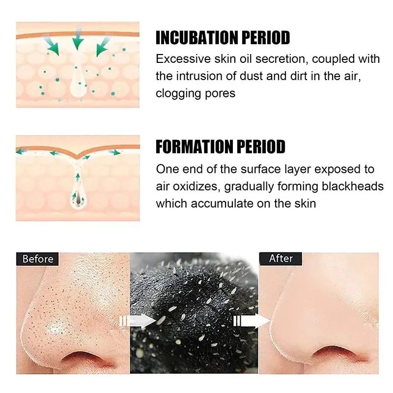 10/150 Pezzi Maschera Rimuovi  - Skincare Indonesia recensione e prezzo